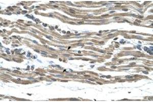 Immunohistochemical staining (Formalin-fixed paraffin-embedded sections) of human muscle with COX15 polyclonal antibody  at 4-8 ug/mL working concentration. (COX15 抗体  (N-Term))