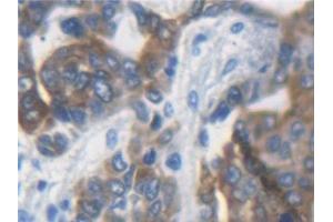 Immunohistochemistry (IHC) image for anti-Keratin 33A (KRT33A) (AA 57-363) antibody (ABIN7441730)