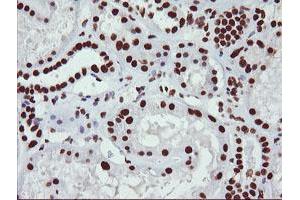 Image no. 8 for anti-Non-POU Domain Containing, Octamer-Binding (NONO) (AA 184-385) antibody (ABIN1491072)