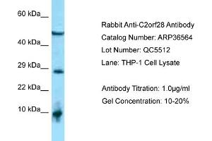 WB Suggested Anti-C2orf28 Antibody   Titration: 1. (ATRAID 抗体  (C-Term))