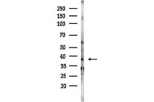 Western blot analysis of lysates from Hela cells(heat-shock,45 min treatment), using OR5 Antibody at 1/1000 dilution.