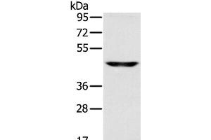 Western Blot analysis of Human fetal brain tissue using SLC16A8 Polyclonal Antibody at dilution of 1:200 (MCT3 抗体)
