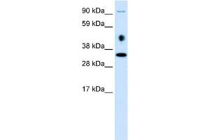 WB Suggested Anti-EN2 Antibody Titration: 0. (EN2 抗体  (C-Term))