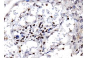 IHC analysis of RAX2 using anti-RAX2 antibody (ABIN7602913).