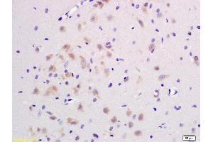 Formalin-fixed and paraffin embedded rat brain labeled with Rabbit Anti JNK1/2/3 Polyclonal Antibody, Unconjugated (ABIN747713) at 1:200 followed by conjugation to the secondary antibody and DAB staining (JNK 抗体  (AA 151-250))