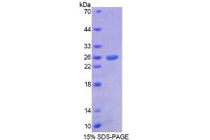 Image no. 1 for Aristaless Related Homeobox (ARX) (AA 25-246) protein (T7 tag,His tag) (ABIN6238744) (Arx Protein (AA 25-246) (T7 tag,His tag))