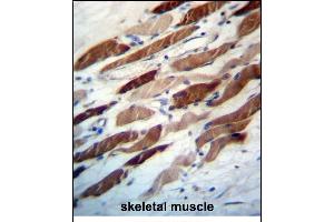 Immunohistochemistry (Paraffin-embedded Sections) (IHC (p)) image for anti-WD Repeat Domain, Phosphoinositide Interacting 2 (WIPI2) (AA 4-32), (N-Term) antibody (ABIN657237)