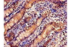 Immunohistochemistry of paraffin-embedded human small intestine tissue using ABIN7175158 at dilution of 1:100 (USP6NL 抗体  (N-Term))