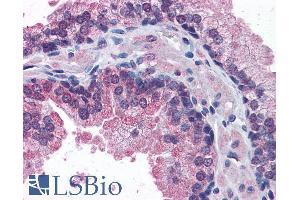 Immunohistochemistry (IHC) image for anti-Signal Transducing Adaptor Family Member 2 (STAP2) (C-Term) antibody (ABIN184610)