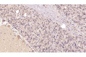 Detection of PTHR2 in Human Cerebellum Tissue using Monoclonal Antibody to Parathyroid Hormone Receptor 2 (PTHR2) (PTH2R 抗体  (AA 27-145))