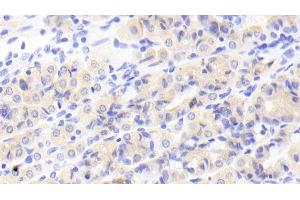 Detection of MAN1A1 in Human Stomach Tissue using Polyclonal Antibody to Mannosidase Alpha Class 1A Member 1 (MAN1A1)
