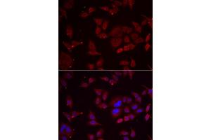 Immunofluorescence analysis of U2OS cell using PFKFB3 antibody. (PFKFB3 抗体)