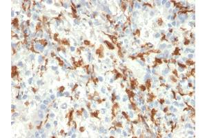 Formalin-fixed, paraffin-embedded human Kidney stained with AIF1 / Iba1 Mouse Monoclonal Antibody (AIF1/2493). (Iba1 抗体  (AA 1-146))
