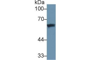 Western Blot; Sample: Human Lung lysate; Primary Ab: 3µg/ml Mouse Anti-Human DBP Antibody Second Ab: 0. (Vitamin D-Binding Protein 抗体  (AA 209-401))