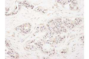 Immunohistochemistry (IHC) image for anti-Zinc Finger Protein, Multitype 1 (ZFPM1) (AA 175-225) antibody (ABIN7448567)