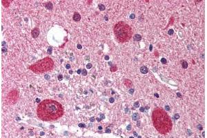 Human Brain, Cerebellum (formalin-fixed, paraffin-embedded) stained with STK11 antibody ABIN214519 at 5 ug/ml followed by biotinylated goat anti-rabbit IgG secondary antibody ABIN481713, alkaline phosphatase-streptavidin and chromogen. (LKB1 抗体  (N-Term))