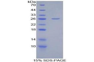 SDS-PAGE analysis of Chicken Adiponectin Protein. (ADIPOQ 蛋白)
