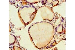 Immunohistochemistry of paraffin-embedded human thyroid tissue using ABIN7167828 at dilution of 1:100 (SCPEP1 抗体  (AA 201-452))