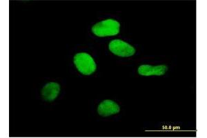 Immunofluorescence of purified MaxPab antibody to RCC1 on HeLa cell. (RCC1 抗体  (AA 1-421))