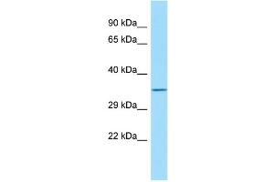 Host: Rabbit Target Name: FAM49B Sample Type: HT1080 Whole Cell lysates Antibody Dilution: 1. (FAM49B 抗体  (C-Term))