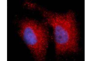 Immunofluorescence (IF) image for anti-Integrin beta 1 (ITGB1) (AA 21-461) antibody (APC) (ABIN5566381) (ITGB1 抗体  (AA 21-461) (APC))
