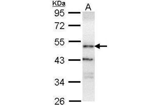 OSBPL1A 抗体  (C-Term)