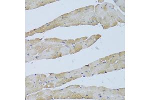 Immunohistochemistry of paraffin-embedded mouse heart using TRAP1 Antibody (ABIN1875197) at dilution of 1:100 (40x lens). (TRAP1 抗体)