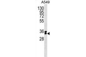Western Blotting (WB) image for anti-F-Box Protein 44 (FBXO44) antibody (ABIN5019782) (FBXO44 抗体)