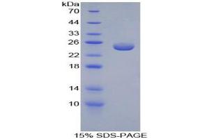SDS-PAGE analysis of Mouse Peroxiredoxin 5 Protein. (Peroxiredoxin 5 Protein (PRDX5))