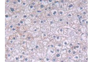 IHC-P analysis of Human Liver Tissue, with DAB staining. (FADS2 抗体  (AA 1-130))