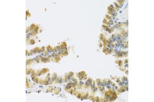 Immunohistochemistry of paraffin-embedded mouse lung using NMU antibody (ABIN6290689) at dilution of 1:100 (40x lens). (Neuromedin U 抗体)