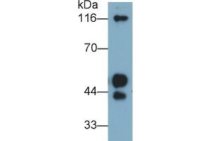 Detection of KNG1 in Human Plasma using Polyclonal Antibody to Kininogen 1 (KNG1) (KNG1 抗体  (AA 390-644))
