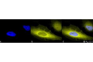 Immunocytochemistry/Immunofluorescence analysis using Rabbit Anti-Ubiquitin Polyclonal Antibody . (Ubiquitin 抗体  (Atto 390))