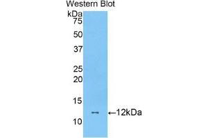 Detection of Recombinant DBI, Mouse using Polyclonal Antibody to Diazepam Binding Inhibitor (DBI) (Diazepam Binding Inhibitor 抗体  (AA 2-87))