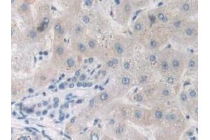 Detection of TNFa in Human Liver Tissue using Polyclonal Antibody to Tumor Necrosis Factor Alpha (TNFa)
