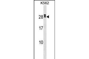 IL15RA Antibody (Center) (ABIN1538627 and ABIN2850245) western blot analysis in K562 cell line lysates (35 μg/lane). (IL15RA 抗体  (AA 79-106))