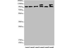 Western blot All lanes: NAA25 antibody at 2. (NAA25 抗体  (AA 703-972))