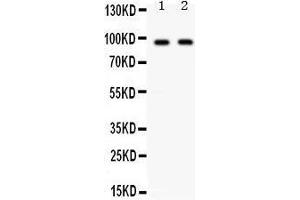 Western Blotting (WB) image for anti-CD22 Molecule (CD22) (AA 696-724), (C-Term) antibody (ABIN3043390) (CD22 抗体  (C-Term))