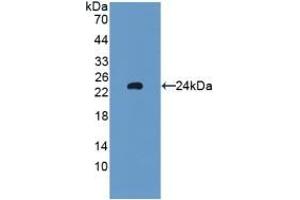 Detection of Recombinant GPX5, Rat using Polyclonal Antibody to Glutathione Peroxidase 5 (GPX5) (GPX5 抗体  (AA 22-221))