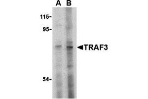 Western Blotting (WB) image for anti-TNF Receptor-Associated Factor 3 (TRAF3) (N-Term) antibody (ABIN1031640)