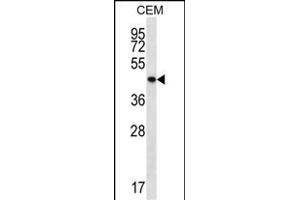 PTPN2 antibody  (C-Term)