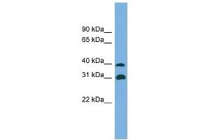 Crystallin Mu antibody used at 1 ug/ml to detect target protein. (CRYM 抗体  (Middle Region))