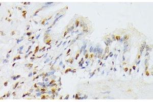Immunohistochemistry of paraffin-embedded Rat lung using ANKRD52 Polyclonal Antibody at dilution of 1:100 (40x lens). (ANKRD52 抗体)