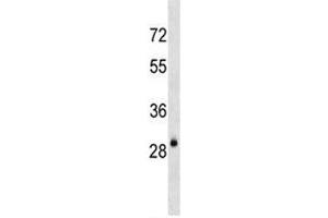 AQP3 antibody western blot analysis in mouse kidney tissue lysate (AQP3 抗体  (AA 163-191))