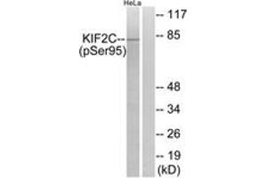 Western blot analysis of extracts from HeLa cells treated with TNF 10ng/ml 30', using KIF2C (Phospho-Ser95) Antibody.