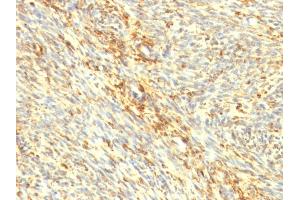 Formalin-fixed, paraffin-embedded human Uterus stained with Transglutaminase II Mouse Monoclonal Antibody (SPM358).