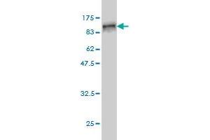 Western Blot detection against Immunogen (89. (Radixin 抗体  (AA 1-583))