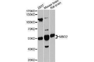 Western blot analysis of extracts of various cell lines, using MBD2 antibody (ABIN5998188) at 1:3000 dilution. (MBD2 抗体)