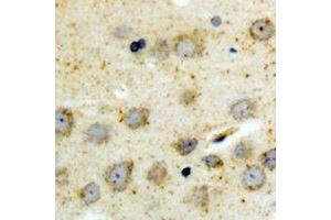 Immunohistochemical analysis of BID (pS78) staining in human brain formalin fixed paraffin embedded tissue section. (BID 抗体  (pSer78))