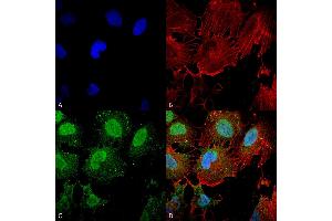 Immunocytochemistry/Immunofluorescence analysis using Mouse Anti-mGluR1/5 glutamate receptor Monoclonal Antibody, Clone S75-3 . (Metabotropic Glutamate Receptor 5 抗体  (AA 824-1203) (PE))